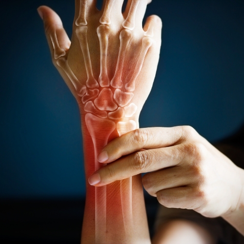 wrist-pain-relief-Solutions-Physical-Therapy-and-Sports-Medicine-Alexandria-Springfield-VA
