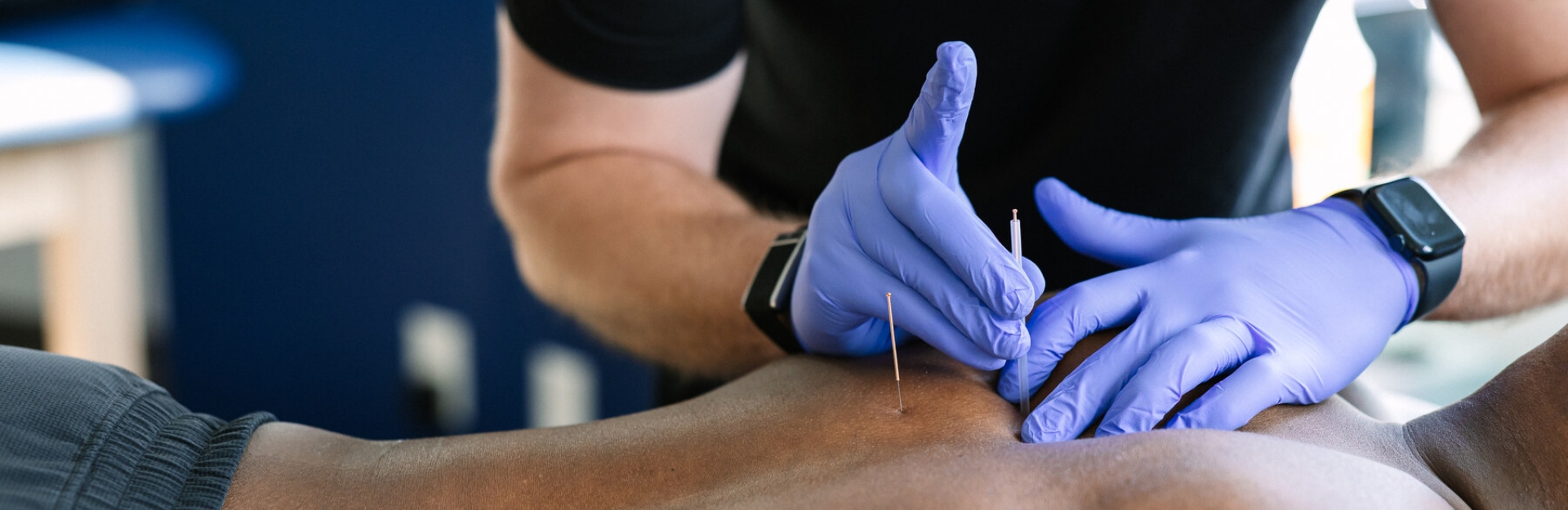 Dry Needling