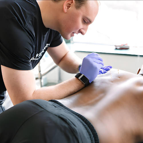 dry-needling-homepage-full-strength-physical-therapy-arlington-springfield-alexandria-va