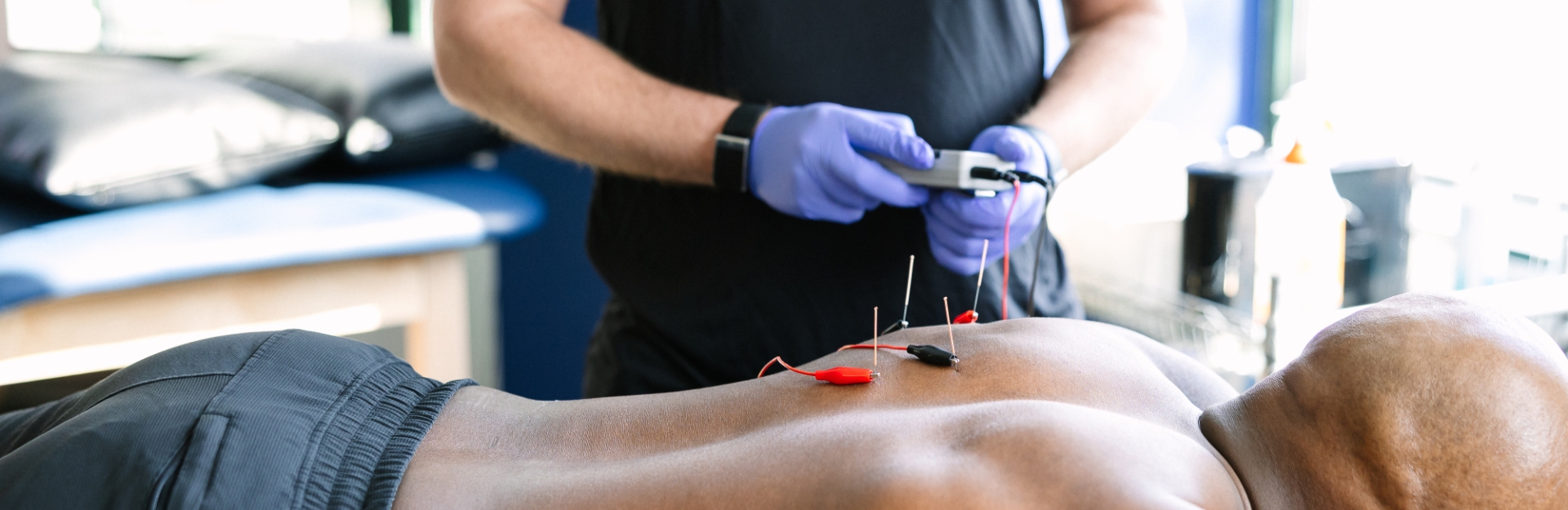 Electrical Stimulation