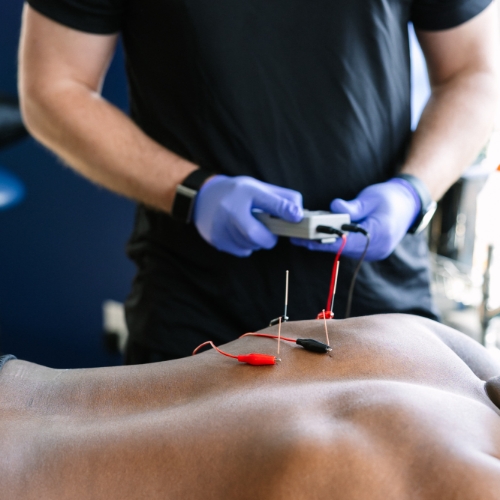 electrical-stimulation-Full-Strength-Arlington-Springfield-Alexandria-VA